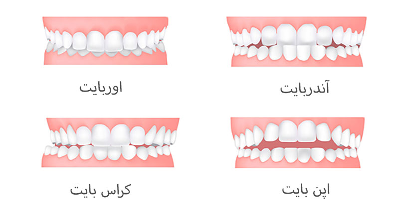 ناهنجاری های دندانی