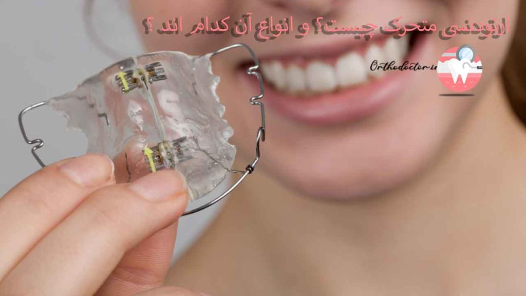 ارتودنسی متحرک
