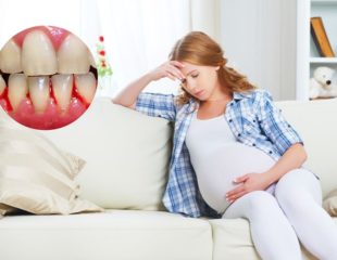 دندانپزشکی بارداری
