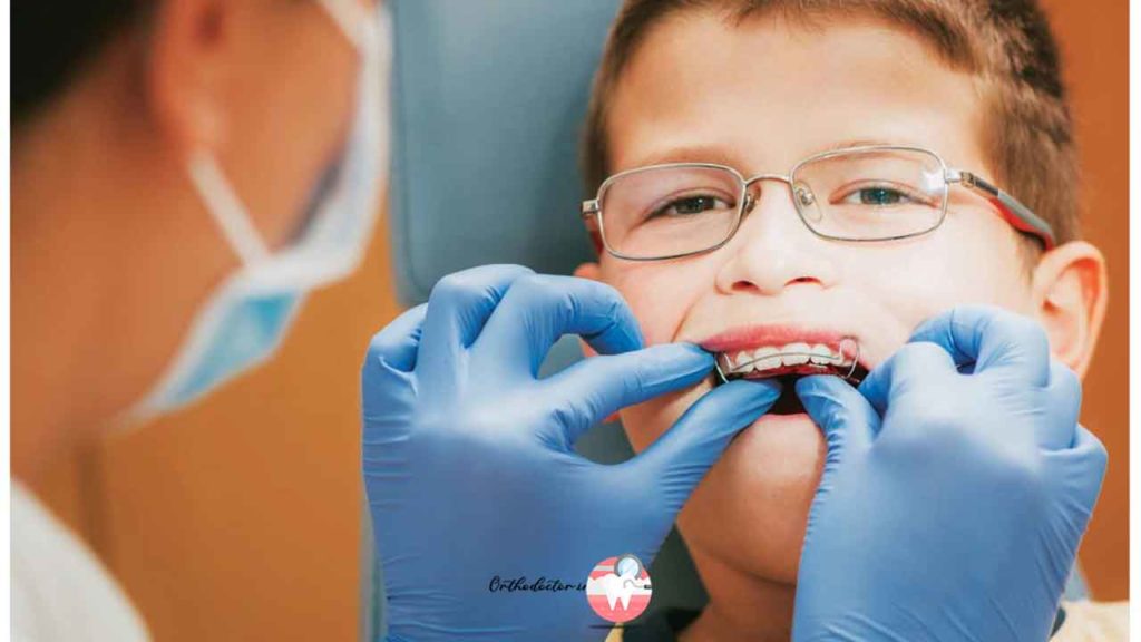 ارتودنسی دندان کودکان 