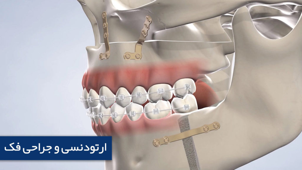 ارتودنسی و جراحی فک