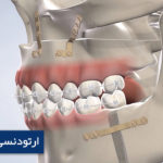 ارتودنسی و جراحی فک