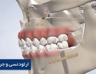 ارتودنسی و جراحی فک