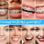 ارتودنسی زودبازده