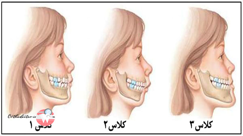 مزایای درمان ارتودنسی
