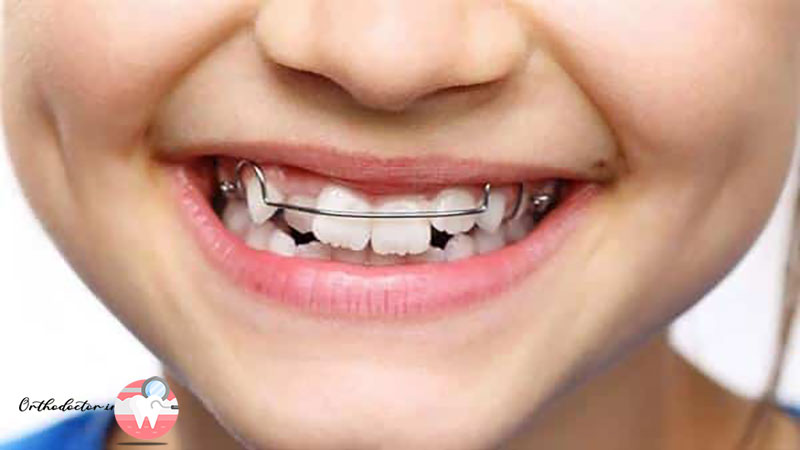مشکلات دندان کودکان