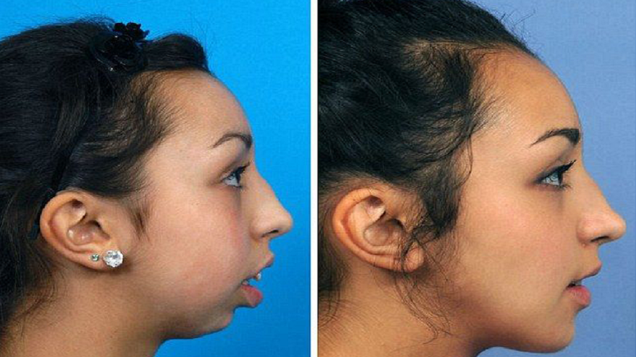 روش های زیبایی دندان و ارتودنسی
