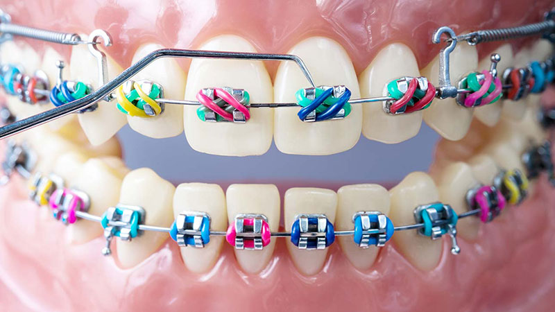 ارتودنسی دندان چیست
