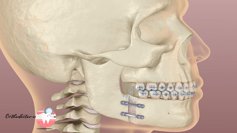 ارتودنسی و جراحی فک
