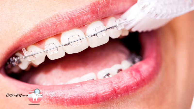مشکل در بهداشت دهان و دندان