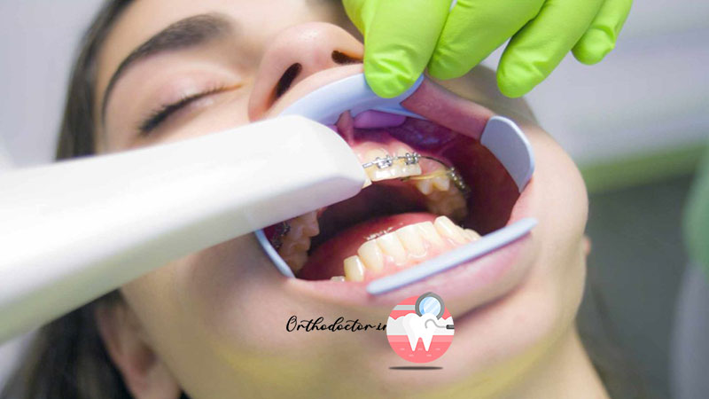 تخصص و مهارت بالای ارتودنتیست 